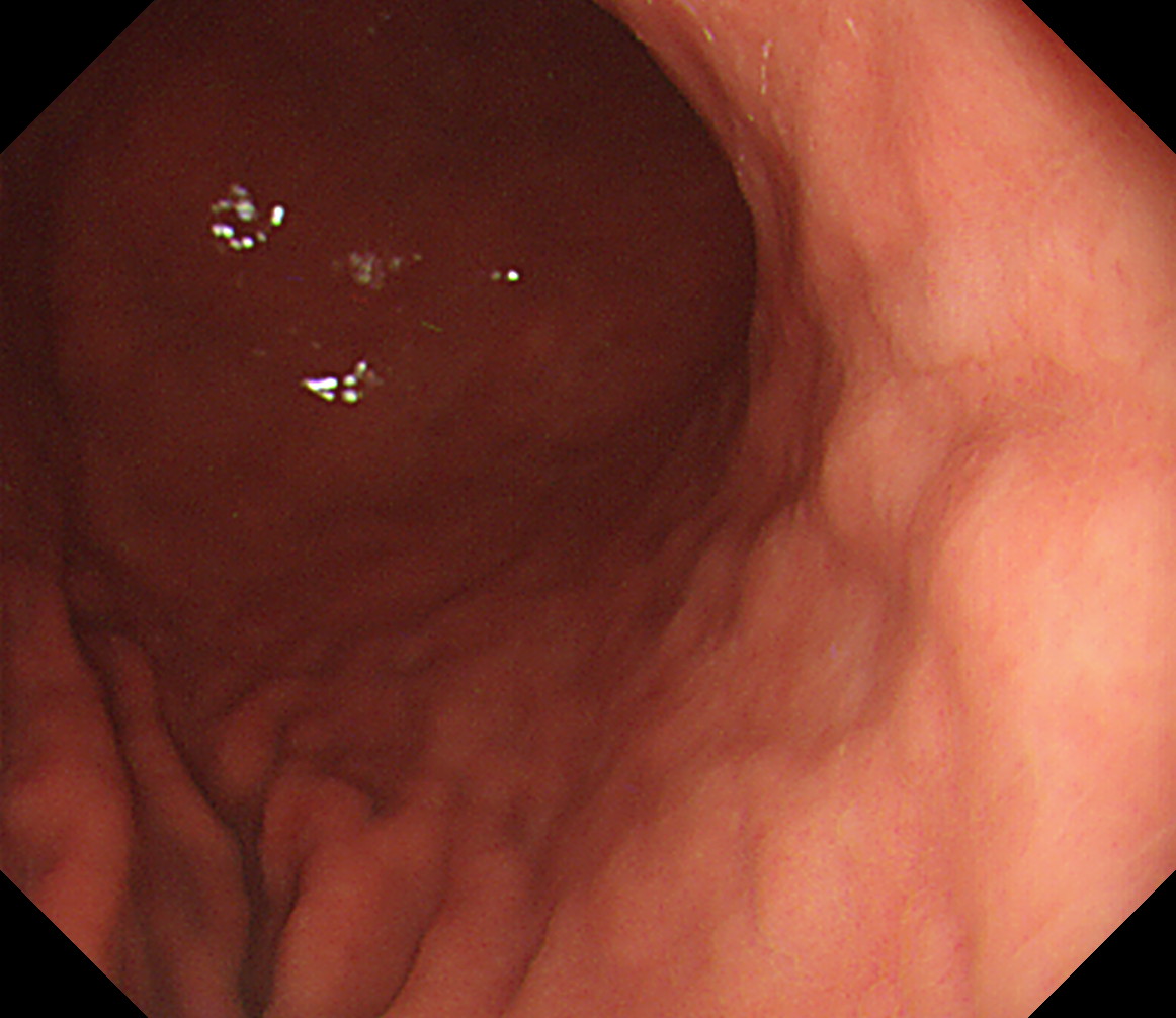 �̉������